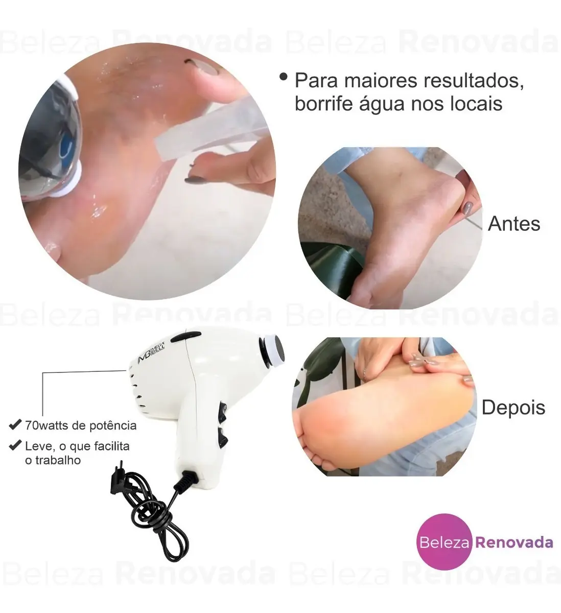 APARELHO PROFISSIONAL PEDICURO MOTOR LIXAR P/ PE COMPACT MEGA BELL 220V BRANCO - Imagem 2